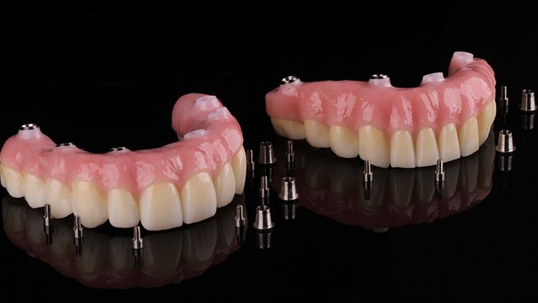 Зубной ряд из циркония с реалистичной с имитацией десны для протезирования на имплантатах